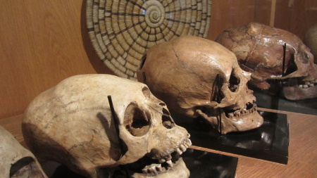 Bone_Collection.jpg