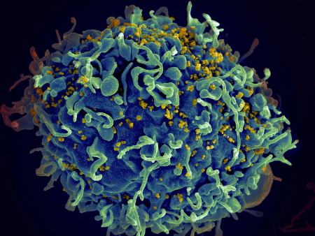 HIV.jpg